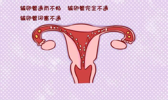 月经正常排卵期备孕为什么还是怀不了，看看是不是因为这个导致的