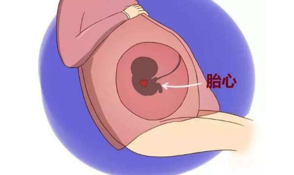 孕期胎儿缺氧是什么原因？应该怎么预防呢？来看看吧