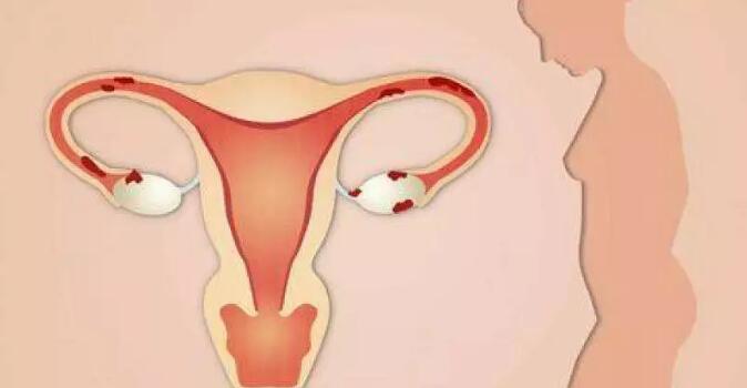 卵巢功能不好能做试管​婴儿吗？这三点分析需明白！为你指明方向！