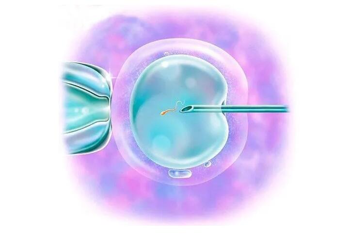 试管婴儿胚胎移植一个还是两个好