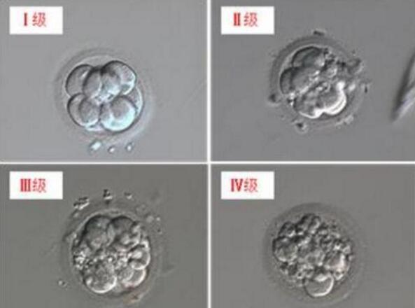 怎样选择优质胚胎来提高试管成功率？专家解读：要具备这三个条件才算！