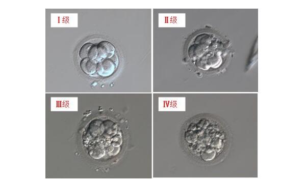 做试管有三级胚胎可以移植吗？医生揭秘胚胎评分与移植策略的关系！
