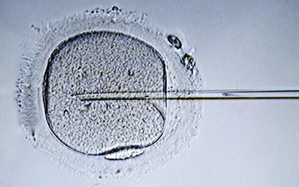 总结养囊5天与6天的胚胎会有什么样的区别，养囊是个怎么样的过程！
